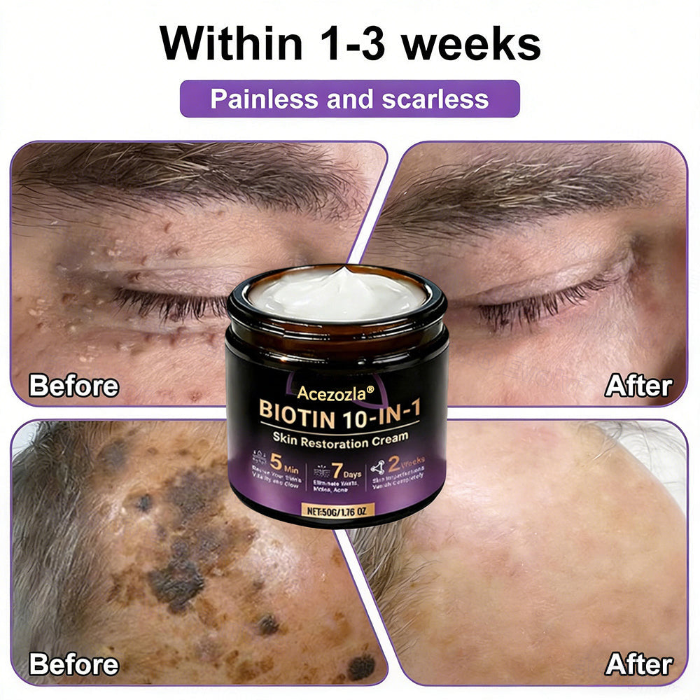 Made and Shipped from USA ✨Acezozla® Biotin 10-in-1 Skin Restoration Cream 🍀