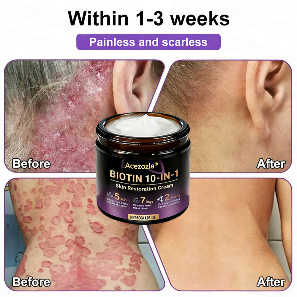 Made and Shipped from USA ✨Acezozla® Biotin 10-in-1 Skin Restoration Cream 🍀