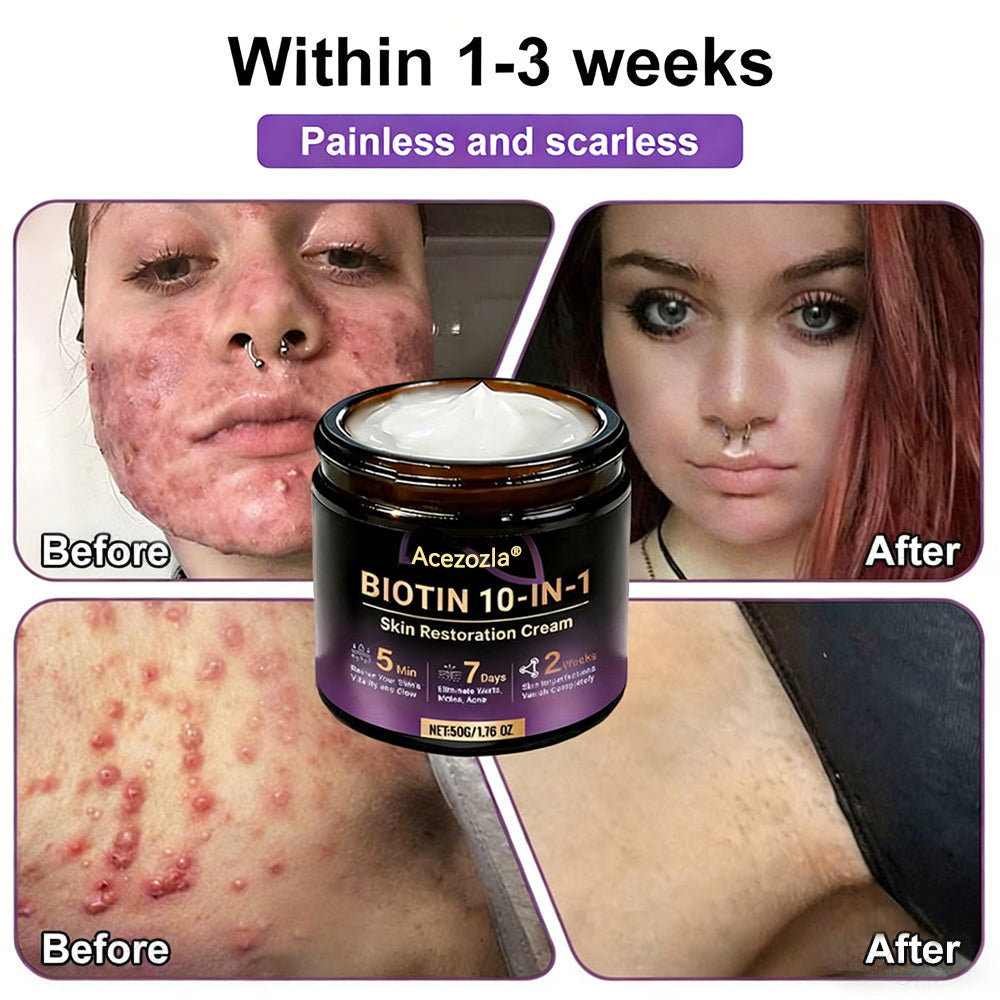 Made and Shipped from USA ✨Acezozla® Biotin 10-in-1 Skin Restoration Cream 🍀